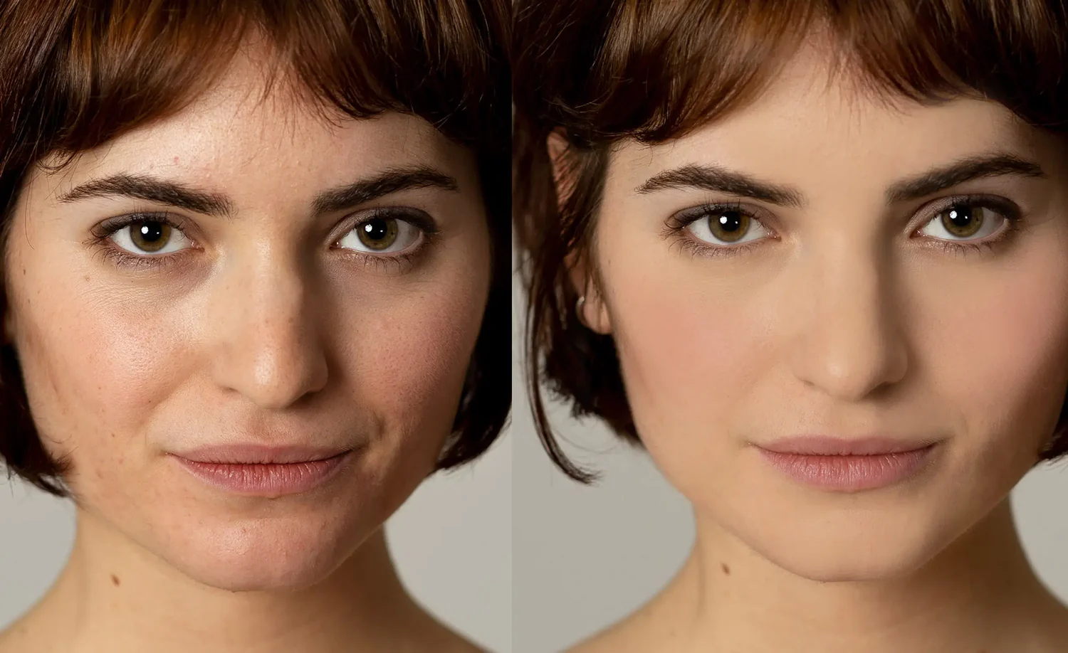 5 remedios caseros para la piel grasa