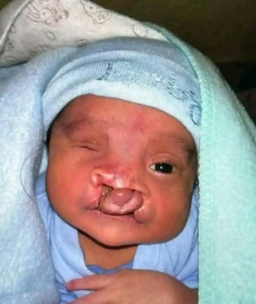 ATENCION Nace el bebé más raro del mundo, nadie creía que con un…Ver más